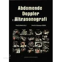 Abdomende Doppler Ultrasonografi