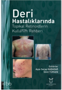 Deri Hastalıklarında Topikal Retinoidlerin Kullanım Rehberi