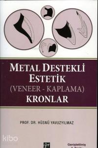 Metal Destekli Estetik (Veneer - Kaplama) Kronlar