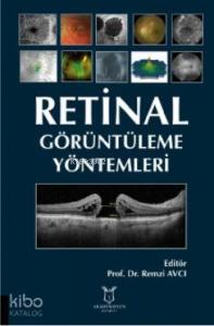 Retinal Görüntüleme Yöntemleri