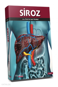 Siroz