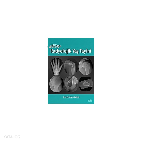 Adli Tıpta Radyolojik Yaş Tayini