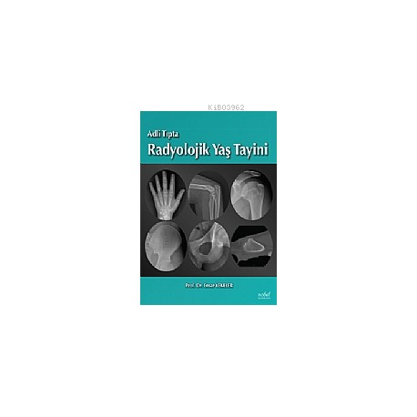 Adli Tıpta Radyolojik Yaş Tayini