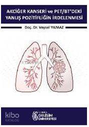 Akciğer Kanseri ve PET/BT'deki Yanlış Pozitifliğin İrdelenmesi