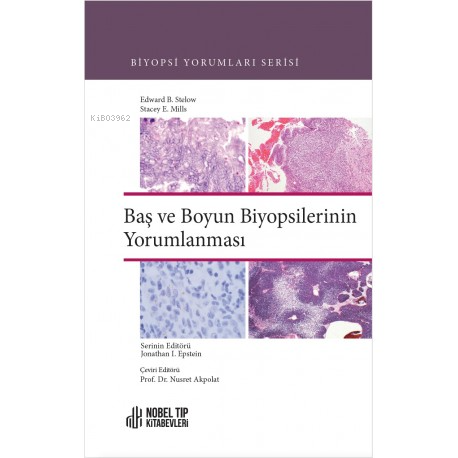 Biyopsi Yorumları Serisi:Baş Ve Boyun Biyopsilerinin Yorumlanması - Ki