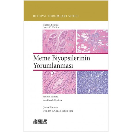 Biyopsi Yorumları Serisi:;Meme Biyopsilerinin Yorumlanması - Kitapiks.