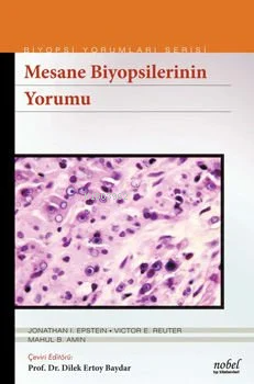 Biyopsilerin Yorumu:Mesane - Kitapiks.com