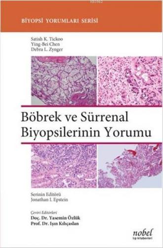 Böbrek ve Sürrenal Biyopsilerinin Yorumu - Kitapiks.com