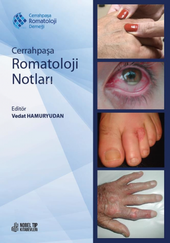 Cerrahpaşa Romatoloji Notları - Kitapiks.com