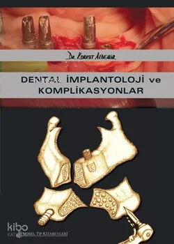 Dental İmplantoloji Ve Komplikasyonlar