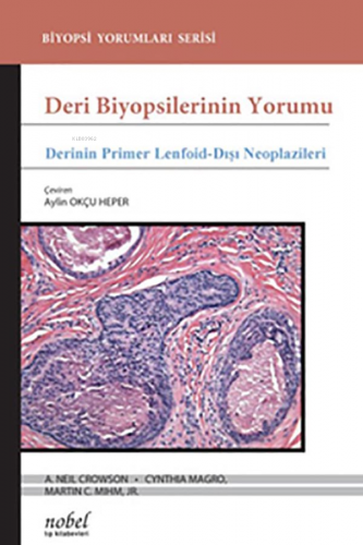 Deri Biyopsilerinin Yorumu: Derinin Primer Lenfoid-Dışı Neoplazileri -