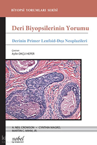 Deri Biyopsilerinin Yorumu: Derinin Primer Lenfoid-Dışı Neoplazileri