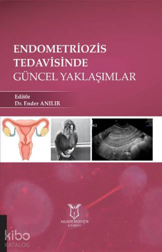 Endometriozis Tedavisinde Güncel Yaklaşımlar