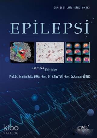 Epilepsi