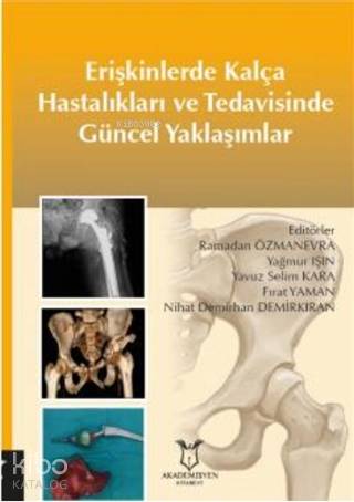 Erişkinlerde Kalça Hastalıkları ve Tedavisinde Güncel Yaklaşımlar