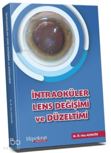 İntraoküler Lens Değişimi ve Düzeltimi