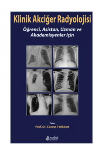 Klinik Akciğer Radyolojisi - Kitapiks.com
