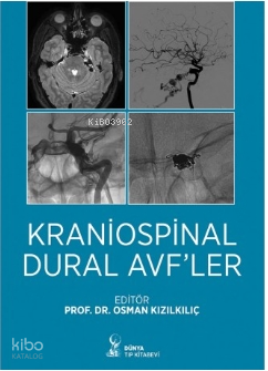 Kraniospinal Dural Avfler