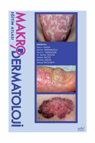 Makrodermatoloji Eğitim Atlası - Kitapiks.com