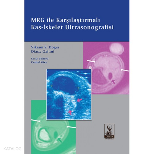 Mrg İle Karşılaştırmalı Kas İskelet Ultrasonografisi