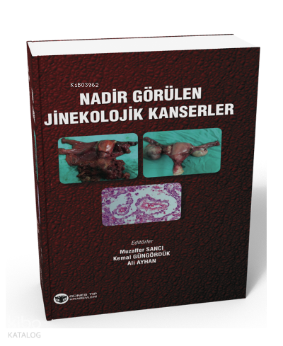 Nadir Görülen Jinekolojik Kanserler