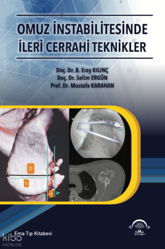 Omuz İntabilitesinde İleri Cerrahi Teknikler