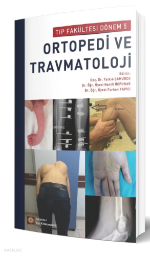Ortopedi ve Travmatoloji Tıp Fakültesi Dönem 5