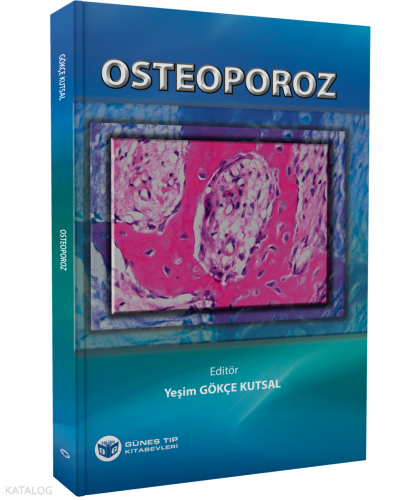 Osteoporoz