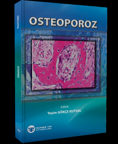 Osteoporoz