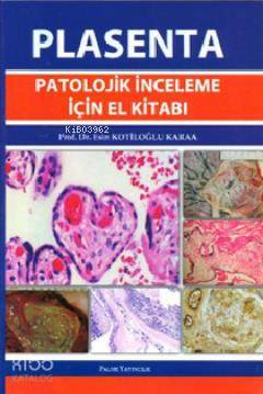 Plasenta Patolojik İnceleme için El Kitabı
