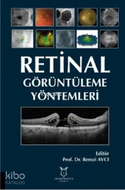 Retinal Görüntüleme Yöntemleri