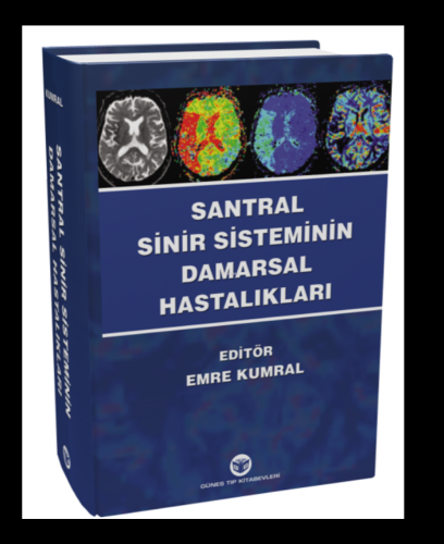 Santral Sinir Sisteminin Damarsal Hastalıkları - Kitapiks.com