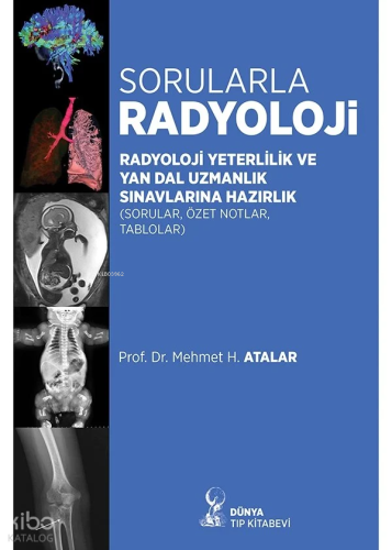 Sorularla Radyoloji: Radyoloji Yeterlilik Ve Yan Dal Uzmanlık Sınavlarına Hazırlık (Sorular, Özel Notlar, Tablolar)