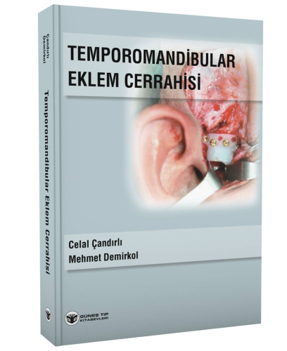Temporomandibular Eklem Cerrahisi
