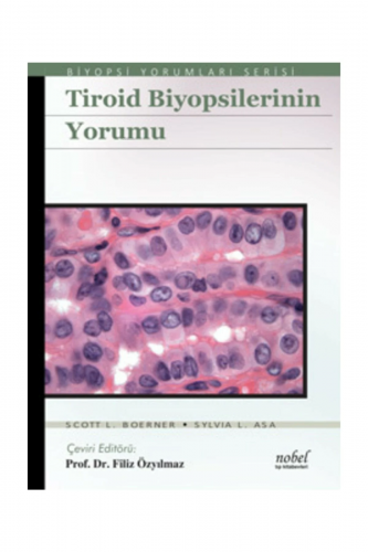 Tiroid Biyopsilerinin Yorumu