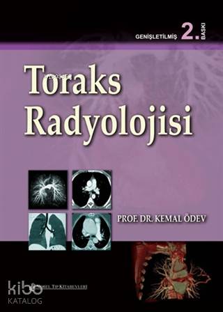 Toraks Radyolojisi
