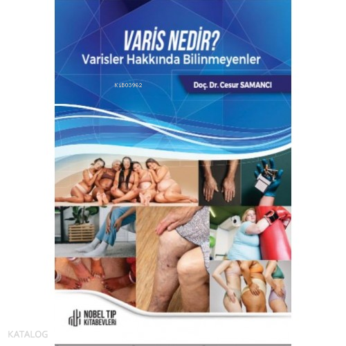 Varis Nedir? Varis Hakkında Bilinmeyenler