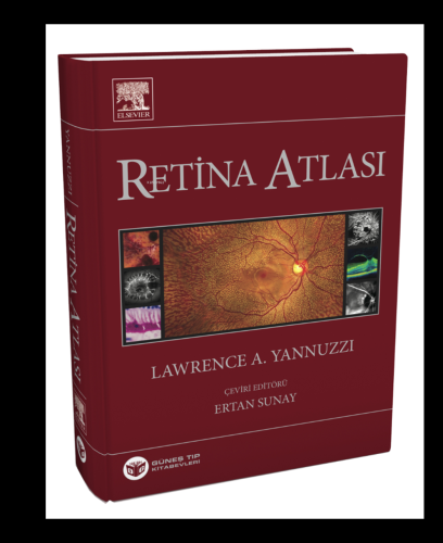 Yannuzzi Retina Atlası - Kitapiks.com