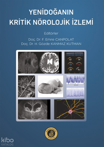 Yenidoğanın Kritik Nöroloji İzlemi